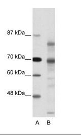 A: Marker, B: Hela Cell Lysate