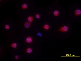 NKp46/NCR1 in NK-92 human cell line NKp46/NCR1 was detected in immersion fixed NK-92 human natural killer lymphoma cell line using Goat Anti-Human NKp46/NCR1 Antigen Affinity-purified Polyclonal Antibody at 10 ug/ml for 3 hours at room temperature. Cells were stained using the NorthernLights 557-conjugated Anti-Goat IgG Secondary Antibody (red) and counterstained with DAPI (blue).