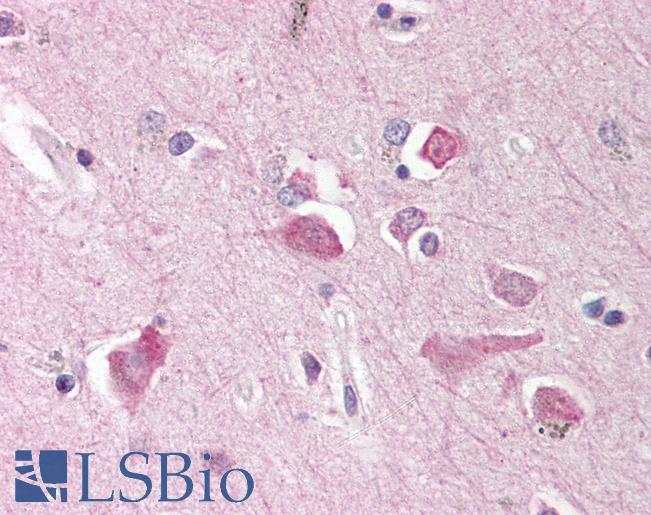 Anti-NCSTN / Nicastrin antibody IHC of human brain, cortex. Immunohistochemistry of formalin-fixed, paraffin-embedded tissue after heat-induced antigen retrieval. Antibody LS-B530 concentration 10 ug/ml.