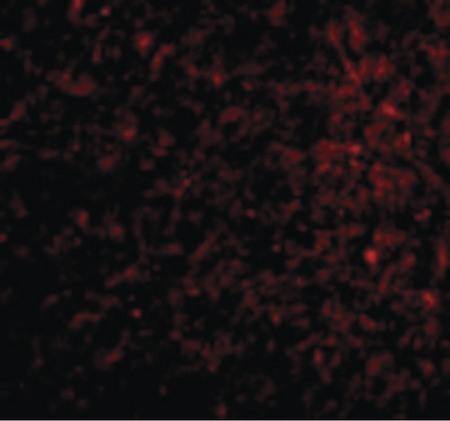 Immunofluorescence of Nicastrin in Human Brain cells with Nicastrin antibody at 20 ug/ml.