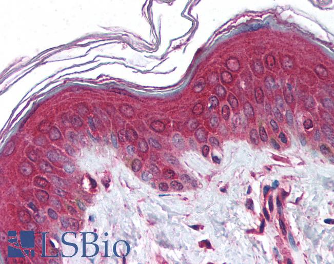 Anti-NCSTN / Nicastrin antibody IHC of human skin. Immunohistochemistry of formalin-fixed, paraffin-embedded tissue after heat-induced antigen retrieval. Antibody LS-B1380 concentration 5 ug/ml.