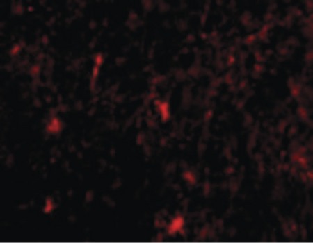 Immunofluorescence of Nicastrin in Human Brain cells with Nicastrin antibody at 20 ug/ml.