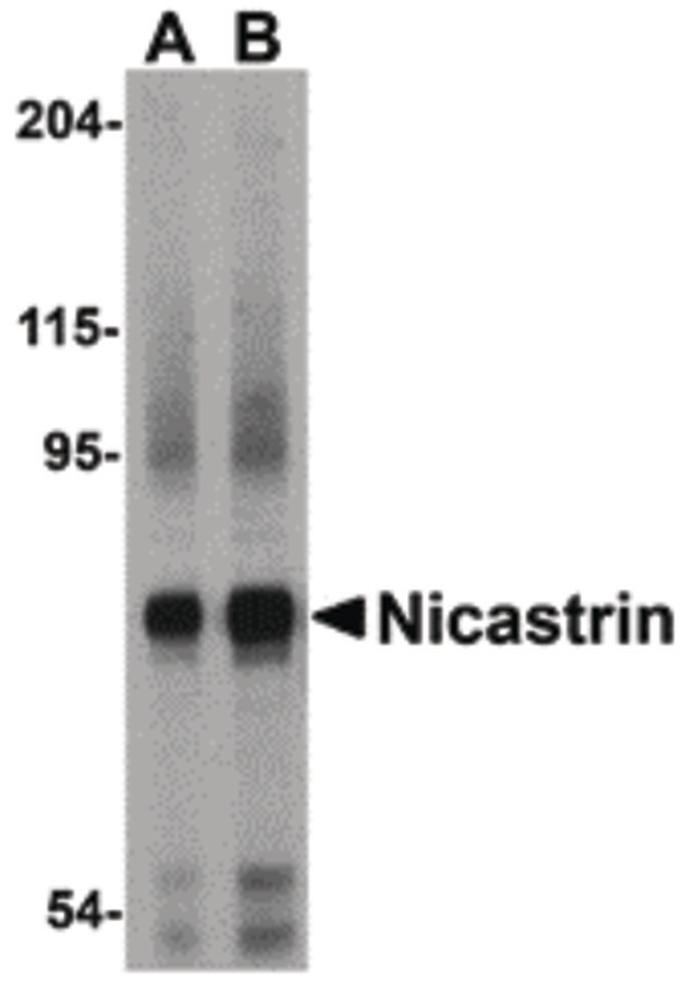 Western blot of Nicastrin in human brain tissue lysate with Nicastrin antibody at (A) 0.5 and (B) 1ug/ml.