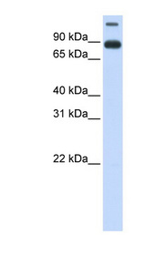 TMEM48 antibody LS-C102214 Western blot of Fetal Lung lysate.