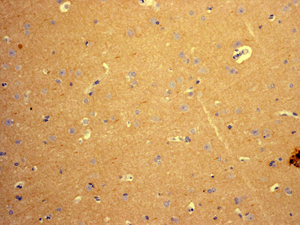IHC of paraffin-embedded human brain tissue using anti-Nudel antibody.