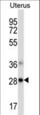 NDFIP1 Antibody western blot of human normal Uterus tissue lysates (35 ug/lane). The NDFIP1 antibody detected the NDFIP1 protein (arrow).