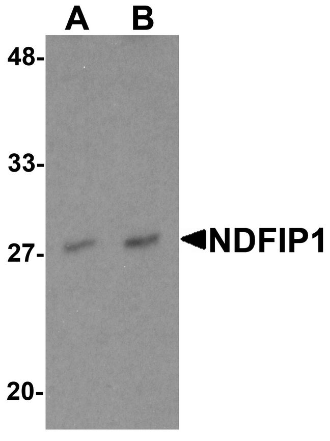 Western blot analysis of NDFIP1 in PC-3 cell lysate with NDFIP1 antibody at (A) 0.5 and (B) 1 ug/ml.