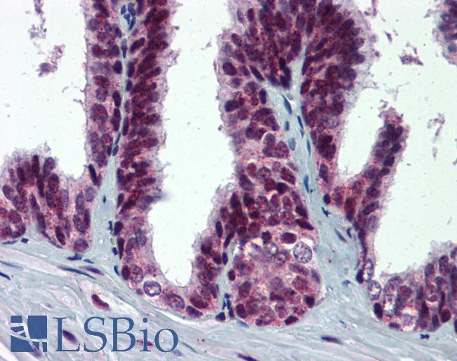 Anti-MDM2 antibody IHC of human prostate. Immunohistochemistry of formalin-fixed, paraffin-embedded tissue after heat-induced antigen retrieval. Antibody LS-B5969 concentration 5 ug/ml.