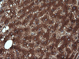IHC of paraffin-embedded Human liver tissue using anti-NDOR1 mouse monoclonal antibody. (Heat-induced epitope retrieval by 10mM citric buffer, pH6.0, 120°C for 3min).