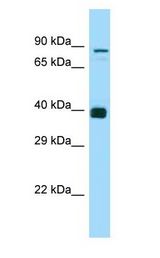 NDOR1 antibody Western Blot of ACHN.