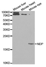 Western blot analysis of extracts of various cell lines, using NDP antibody.
