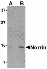 Western blot of Norrin in Jurkat cell lysate with Norrin antibody at (A) 1 and (B) 2 ug/ml. Below: Immunocytochemistry of Norrin in Jurkat cells with Norrin antibody at 5 ug/ml.