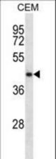 NDRG2 Antibody western blot of CEM cell line lysates (35 ug/lane). The NDRG2 antibody detected the NDRG2 protein (arrow).