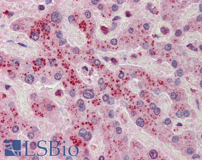 Anti-NDRG2 antibody IHC of human liver. Immunohistochemistry of formalin-fixed, paraffin-embedded tissue after heat-induced antigen retrieval. Antibody LS-B5805 concentration 5 ug/ml.