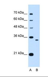 Lane A: Marker. Lane B: HepG2 cell lysate. Antibody concentration: 0.25 ug/ml. Gel concentration: 12%.