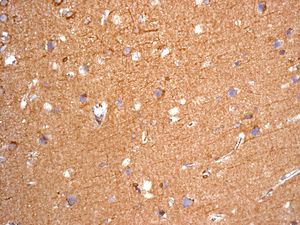 IHC of paraffin-embedded human brain tissue using anti-NDRG3 antibody.