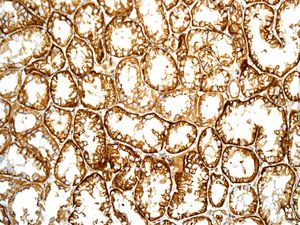 IHC of paraffin-embedded human kidney tissue using anti-NDRG3 antibody.