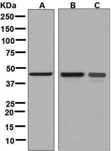 Western blot analysis on (A) Raji, (B) fetal brain, and (C) LnCaP lysates using anti-NDRG3 antibody.
