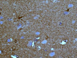 IHC of paraffin-embedded human brain tissue using anti-NDRG3 antibody.