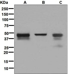 Western blot analysis on (A) fetal brain, (B) Raji, and (C) LnCaP lysates using anti-NDRG3 antibody.