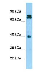 NDRG4 antibody Western Blot of PANC1.