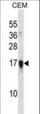 FAM163A Antibody western blot of CEM cell line lysates (35 ug/lane). The FAM163A antibody detected the FAM163A protein (arrow).