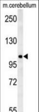 NDST2 Antibody western blot of mouse cerebellum tissue lysates (15 ug/lane). The NDST2 antibody detected NDST2 protein (arrow).