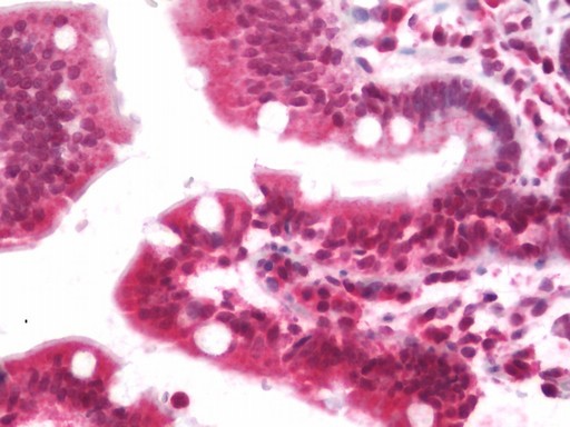 Human Small Intestine: Formalin-Fixed, Paraffin-Embedded (FFPE)