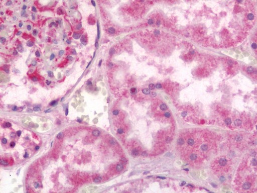 Human Kidney: Formalin-Fixed, Paraffin-Embedded (FFPE)