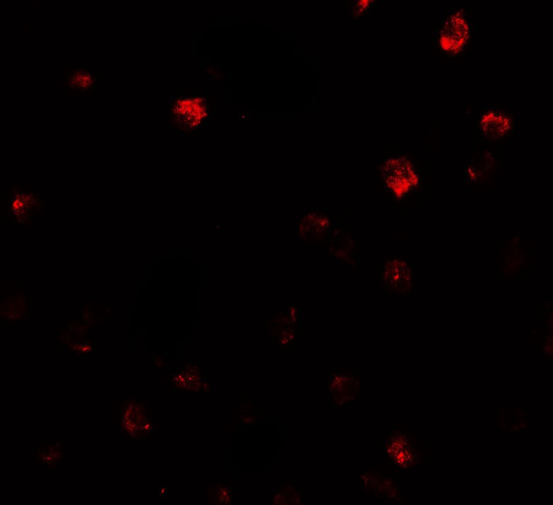 Immunofluorescence of NDST2 in Daudi cells with NDST2 antibody at 20 ug/ml.