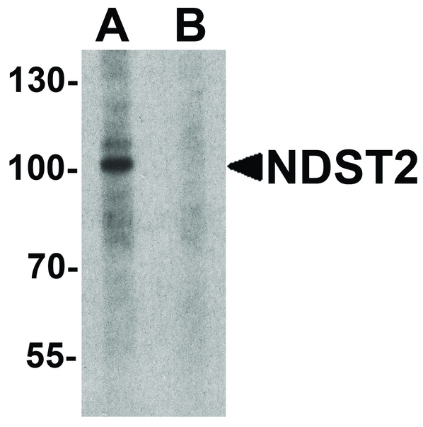 Western blot analysis of NDST2 in A-20 cell lysate with NDST2 antibody at 1 ug/ml in (A) the absence and (B) the presence of blocking peptide.
