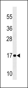 NDUFA12 Antibody western blot of A2058 cell line lysates (35 ug/lane). The NDUFA12 antibody detected the NDUFA12 protein (arrow).