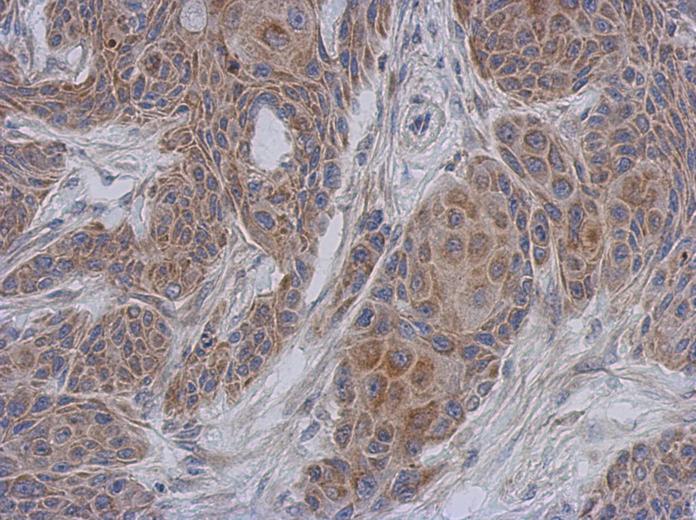 IHC of paraffin-embedded Cal27 xenograft using NDUFA12 antibody at 1:500 dilution.