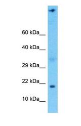 Western blot of NDUFA6 Antibody with human 293T Whole Cell lysate.