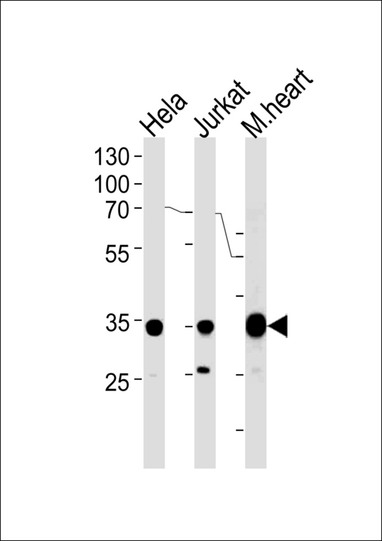 NDUFA9 Antibody western blot of HeLa, Jurkat cell line and mouse heart tissue lysates (35 ug/lane). The NDUFA9 antibody detected the NDUFA9 protein (arrow).