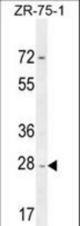 NDUFAF1 Antibody western blot of ZR-75-1 cell line lysates (35 ug/lane). The NDUFAF1 antibody detected the NDUFAF1 protein (arrow).