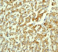 IHC of paraffin-embedded human liver using anti-NDUFAF1 antibody (LS-C105538).