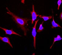 Immunofluorescent staining of HeLa cells using anti-NDUFAF1 antibody (LS-C105538).