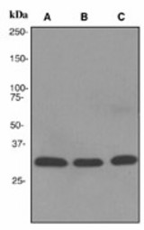 Western blot analysis on (A) HeLa, (B) Jurkat and (C) human heart lysates using anti-NDUFAF1 antibody (LS-C105538).