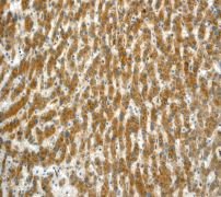 IHC of paraffin-embedded human liver tissue using anti-NDUFAF1 antibody (LS-C105599).