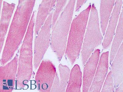Anti-NDUFAF2 / NDUFA12L antibody IHC of human skeletal muscle. Immunohistochemistry of formalin-fixed, paraffin-embedded tissue after heat-induced antigen retrieval. Antibody LS-B8278 dilution 5-10 ug/ml.