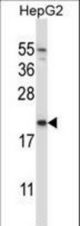NDUFAF2 Antibody western blot of HepG2 cell line lysates (35 ug/lane). The NDUFAF2 antibody detected the NDUFAF2 protein (arrow).