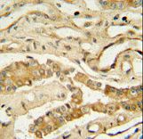 NDUF3 antibody immunohistochemistry of formalin-fixed and paraffin-embedded human lung tissue followed by peroxidase-conjugated secondary antibody and DAB staining.