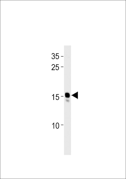 DANRE ndufaf3 Antibody western blot of zebra fish heart tissue lysates (35 ug/lane). The DANRE ndufaf3 antibody detected the DANRE ndufaf3 protein (arrow).
