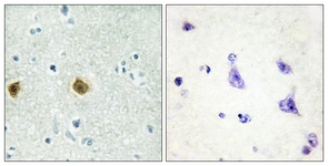 IHC of paraffin-embedded human brain tissue, using NDUC2 Antibody. The picture on the right is treated with the synthesized peptide.