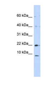NDUFC2 antibody LS-C102232 Western blot of 293T cell lysate.
