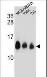 NDUFC2 Antibody western blot of MDA-MB453,HeLa,293 cell line lysates (35 ug/lane). The NDUFC2 antibody detected the NDUFC2 protein (arrow).