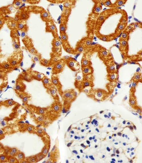 Immunohistochemical of paraffin-embedded R. kidney section using NDUFC2 Antibody. Antibody was diluted at 1:100 dilution. A peroxidase-conjugated goat anti-rabbit IgG at 1:400 dilution was used as the secondary antibody, followed by DAB staining.