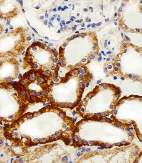 Immunohistochemical of paraffin-embedded H. kidney section using NDUFC2 Antibody. Antibody was diluted at 1:100 dilution. A peroxidase-conjugated goat anti-rabbit IgG at 1:400 dilution was used as the secondary antibody, followed by DAB staining.