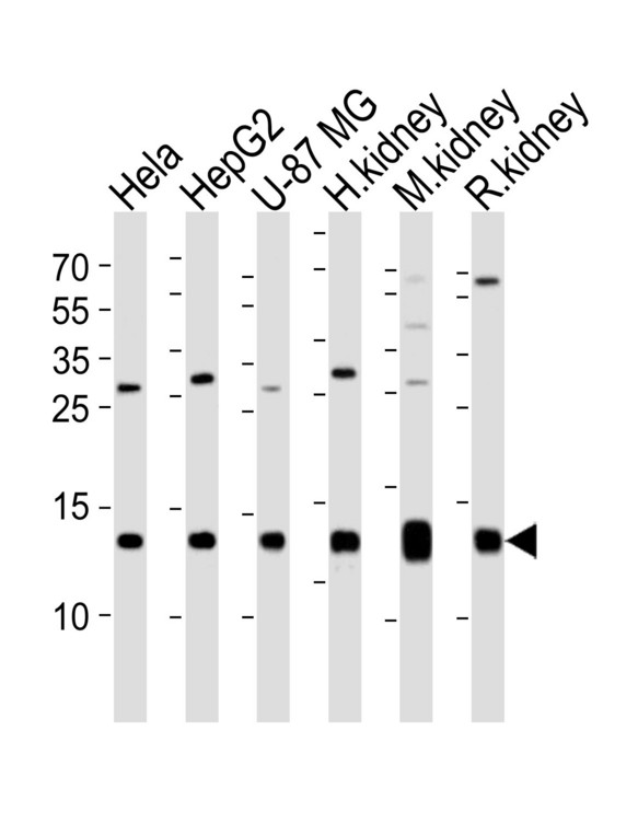 Western blot of lysates from HeLa, HepG2, U-87 MG cell line , human kidney, mouse kidney and rat kidney tissue lysate (from left to right) with NDUFC2 Antibody. Antibody was diluted at 1:1000 at each lane. A goat anti-rabbit IgG H&L (HRP) at 1:5000 dilution was used as the secondary antibody. Lysates at 35 ug per lane.